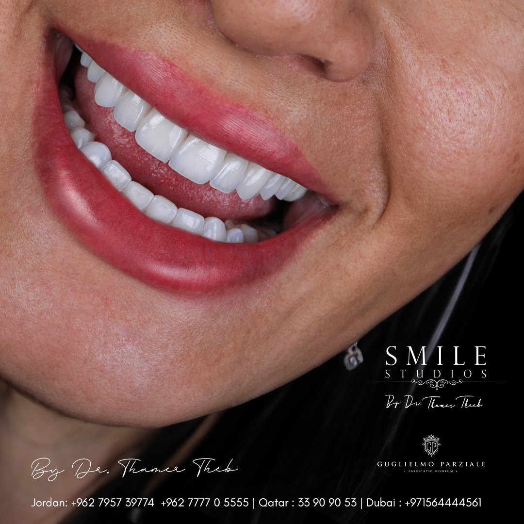 Refashion Your Smile into a Masterpiece 
Handcrafted in Italy, 🌟🇮🇹

#دثامرذيب