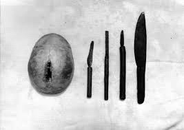 African communities pioneered surgery well before Colombus discovered America. Special surgeons among Abagusiis (Kenya) performed traditional craniotomies, a surgical procedure for removal of portions of the skull to treat head injuries; procedure involved use of anaesthesia.9/16