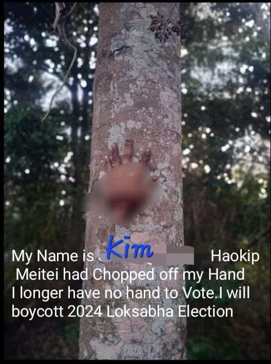 As a sign of solidarity to our fallen heroes, whose hand was chopped off in the recent attack by the #MeiteiMilitias, I, Kim Haokip, boycott the upcoming Lok Sabha 2024. We will not vote until justice is served to the #Kuki_Zo christians @BBCNews @Reuters @IndEditorsGuild