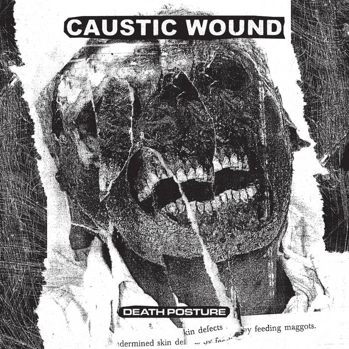 #864
Caustic Wound 
Death Posture (2020)
Deathgrind 🇺🇲