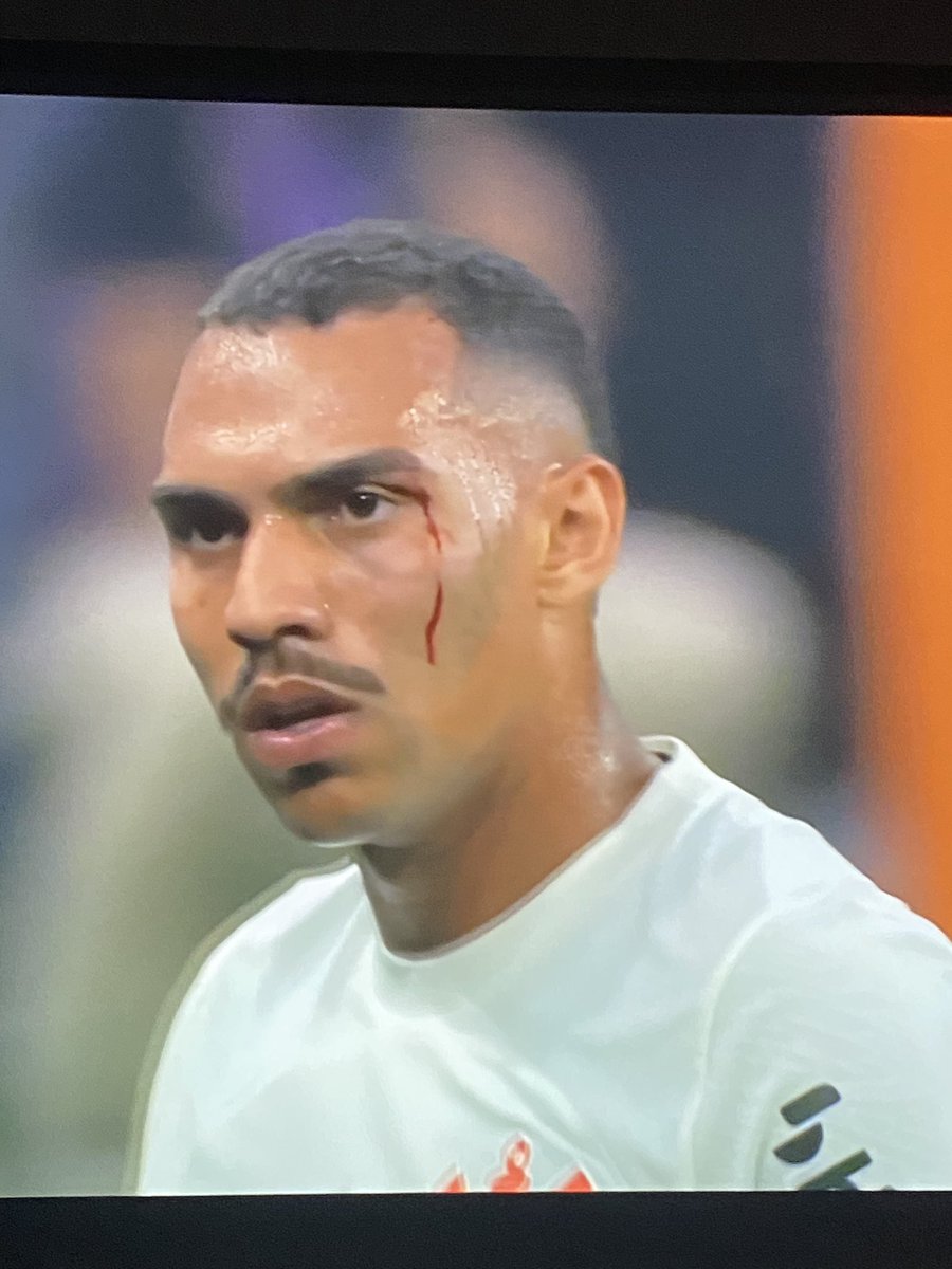 “Não pq o Fagner”