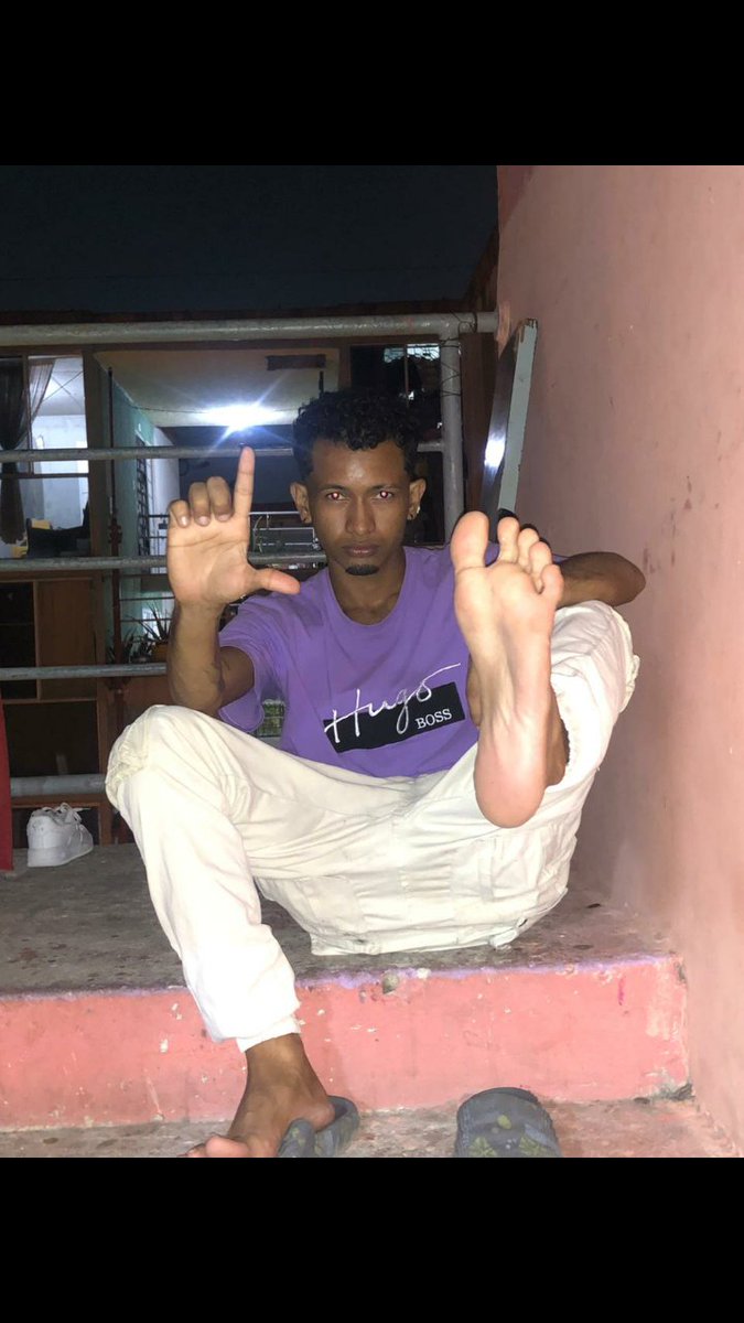 Skallet Blackmail.💸 tweet media