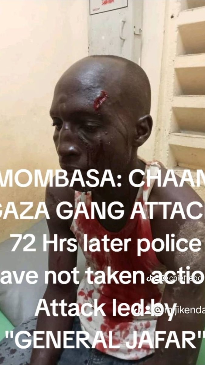 ChiefTebo's tweet photo. Thugs lead by JAFFAR attacked my brother in Mombasa Chaani and robbed him of kshs 100k and mobile phone. 72hours later Police have not made any arrest. Citing they need P3 form to make arrest. Crime will never end in Kenya if this the way the police operate. https://t.co/AJfchUTWu2