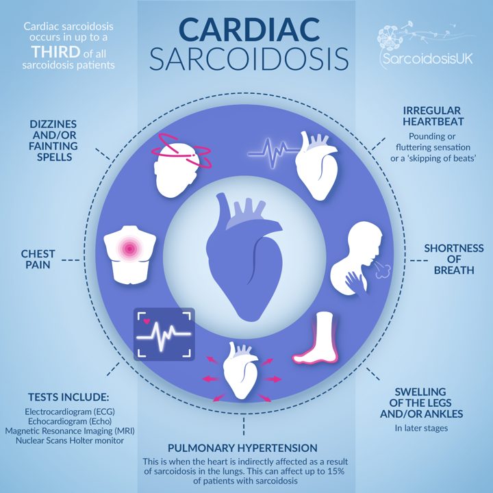 Sarcoidosis can occur in the heart muscle itself #CardiacSarcoidosis. The heart may be indirectly affected as a result of sarcoidosis in the lungs #PulmonaryHypertension. Both can have serious consequences.@SarcoidosisUK ~🦋 #SarcoidosisAwarenessMonth #SarcStrong #SaySarcoidosis