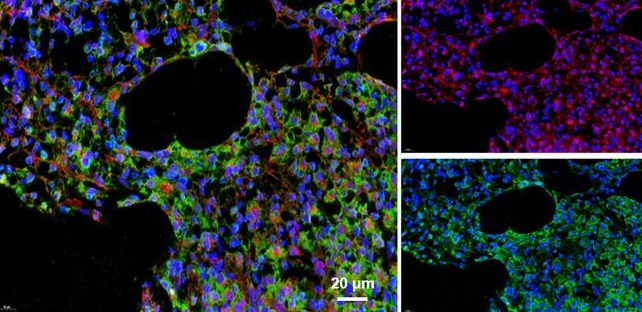 Researchers at Shanghai Jiao Tong University (@sjtu1896) have developed a design concept for CAR-T cells that is independent of antigen specificity, and provides an alternative approach for improving the efficacy of CAR-T cell therapy. 📖 Learn more: bit.ly/3vMgDs3