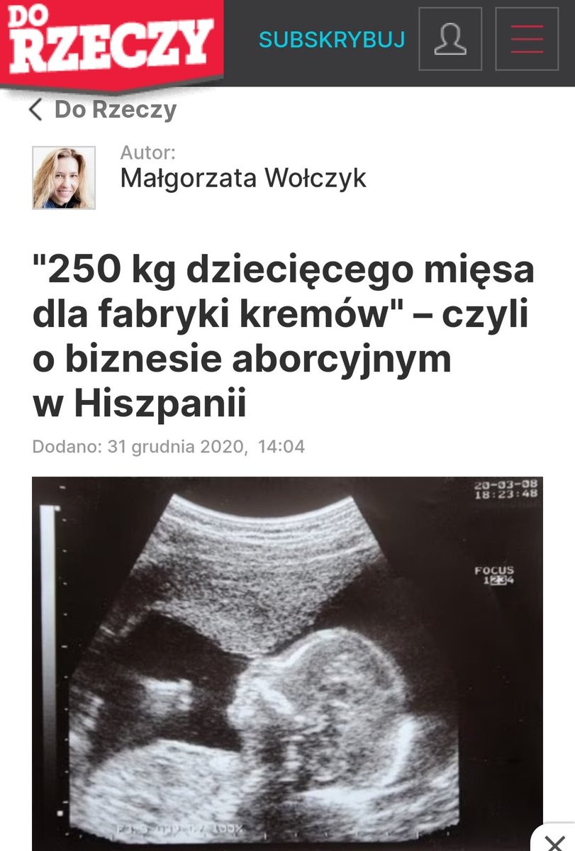 Jowita_W_'s tweet photo. Tu nie chodzi o żaden wybór. 
Tu chodzi o biznes. Abortowane dzieci są źródłem pieniędzy nie tylko dla aborterów. https://t.co/vXIonZcJn1