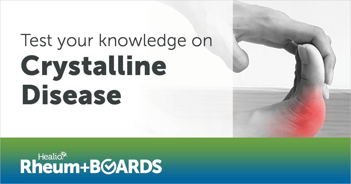 HealioRheum's tweet photo. How useful is checking a serum uric acid level at the time of an acute attack of gout? Quiz yourself with our ready-made topic quiz on #crystallinedisease: https://t.co/EcGuuYvLIz #boardsprep #rheumatology https://t.co/qe8EZtJED9