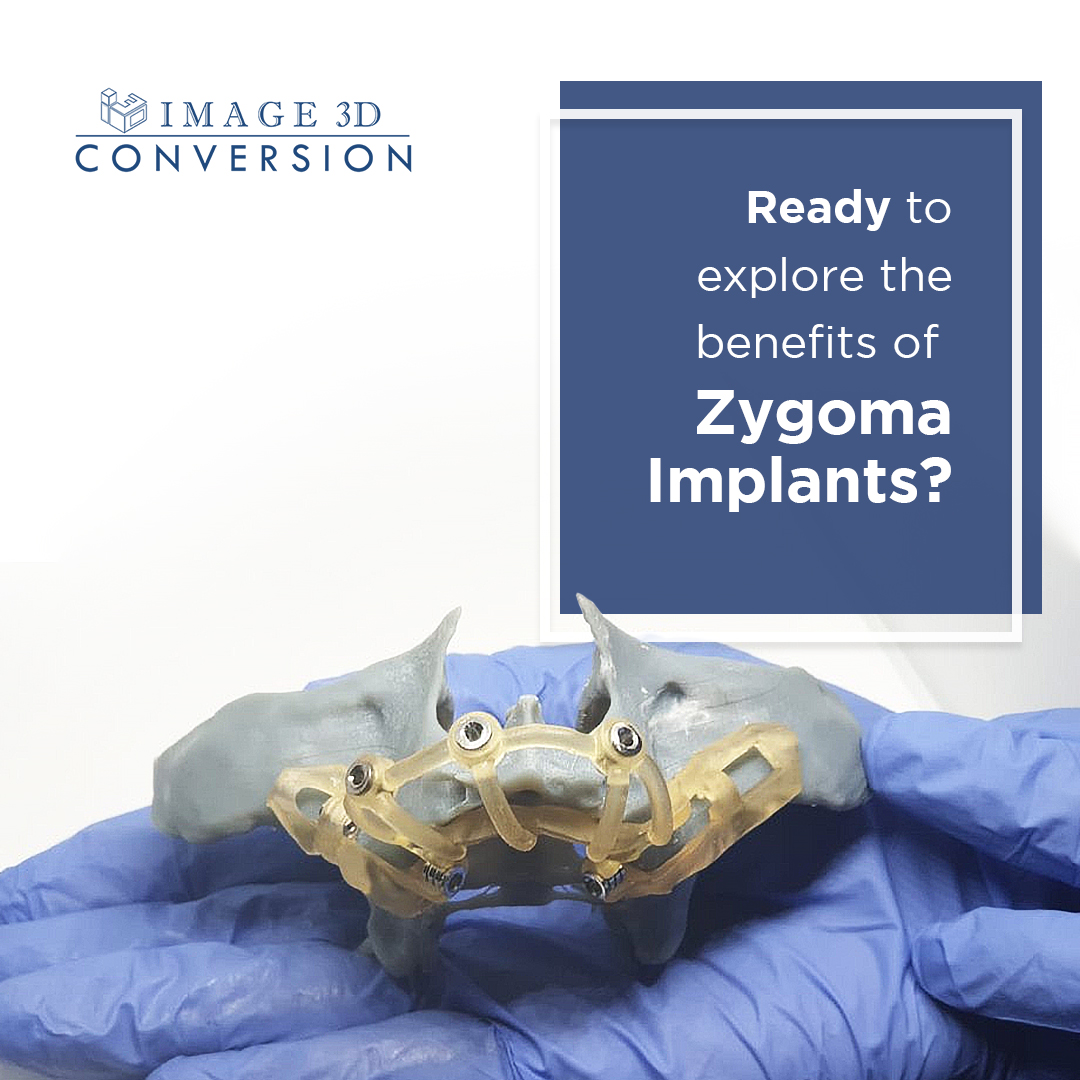 We're all about your smile makeover!

Get the scoop for smart choices and a personalized patient journey. 

Let's make smiles shine together.

#image3dconversion #guidedimplantsurgery #blueskyplan #dentaleducation #bonereductionguided #allonxdentistry #tissuesupportedguide