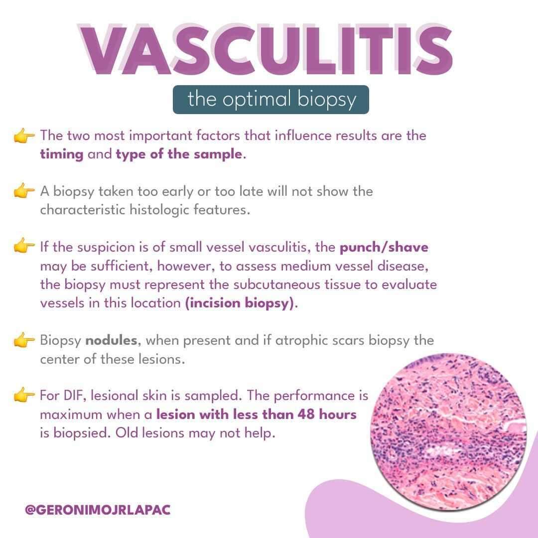 GeronimoJrLapac's tweet photo. 🎯Hi dermatologist and pathologist!
#pathplus #pathology #pathologist #dermpath https://t.co/Ub3MJg3G3y