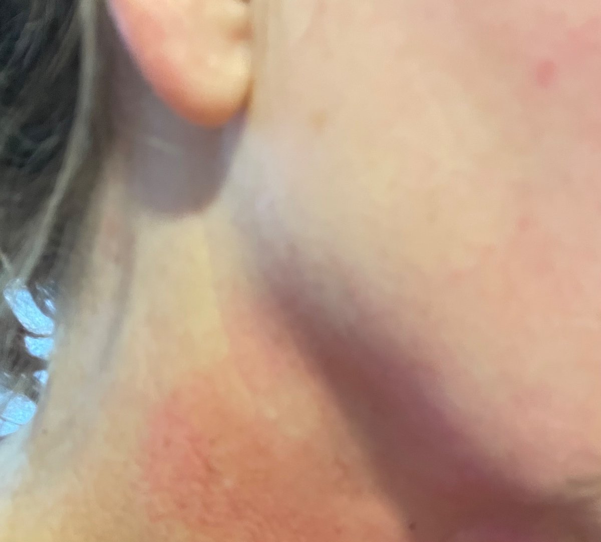 Calling all OREGON peeps—particularly Clack Co and PDX. I was walking by a golf course today when some intoxicated jerks took a shot at me/ hit me in the jaw, leaving me with a hairline fracture. Instead of apologizing, they laughed at me? Do you know who these asshats are?