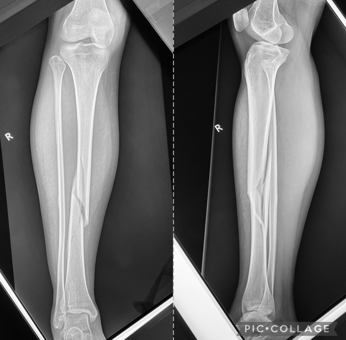 Antonio Tanchuling Jr. M.D. tweet media