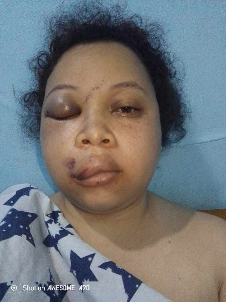 central_sage's tweet photo. URGENT URGENT
🚨 🚨🚨🚨🚨🚨🚨🚨🚨🚨

MEURTRE D'UN MARI SUR SA FEMME. 

MOUSSA MONDO, Jeune cadre du PPRD et ancien Vice ministre des hydrocarbures, vient de tuer sa femme au nom de KHADIDJA ALISA, un sujet malgache, après l'avoir tabassé violemment pour l'amener secrètement à l'hôpital Initiative Plus sur Ex 24 novembre où elle a rendu l'âme suite aux coups 👊 reçus.