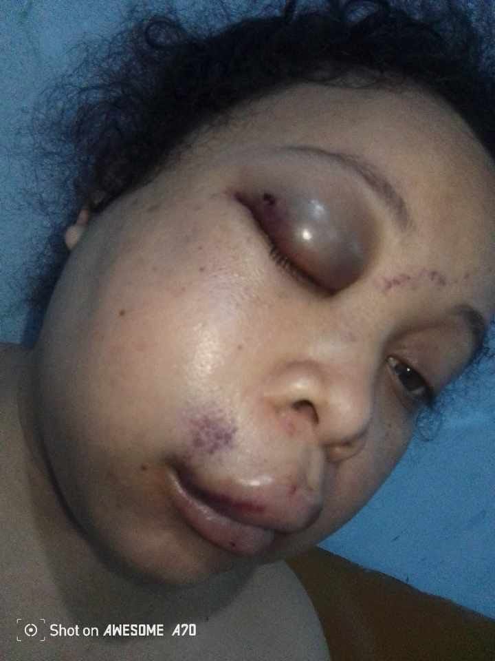central_sage's tweet photo. URGENT URGENT
🚨 🚨🚨🚨🚨🚨🚨🚨🚨🚨

MEURTRE D'UN MARI SUR SA FEMME. 

MOUSSA MONDO, Jeune cadre du PPRD et ancien Vice ministre des hydrocarbures, vient de tuer sa femme au nom de KHADIDJA ALISA, un sujet malgache, après l'avoir tabassé violemment pour l'amener secrètement à l'hôpital Initiative Plus sur Ex 24 novembre où elle a rendu l'âme suite aux coups 👊 reçus.