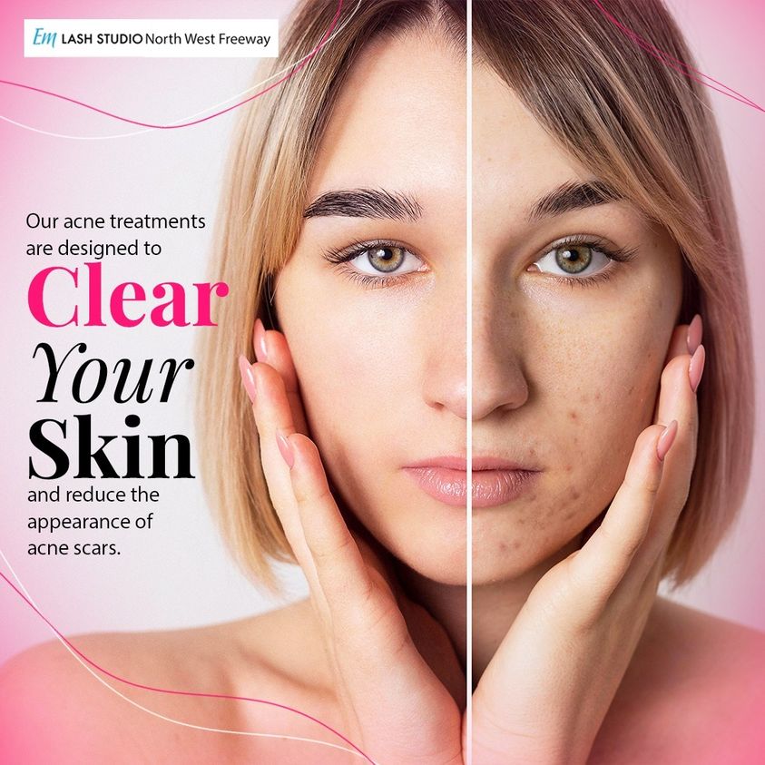 Own your glow, babe 💖
📞 281-616-2612
📍13484 Northwest Fwy, Houston, Texas, 77040, USA.
.
.
.

#bodywaxing #exfoliation #houstonbrows #houstonlashes #flawlessbrows #flawlesslashes #glowingskin  #houstonlife #houston #houstontx #htx #sugarlandtx #houstonwaxing #eyelashextensions