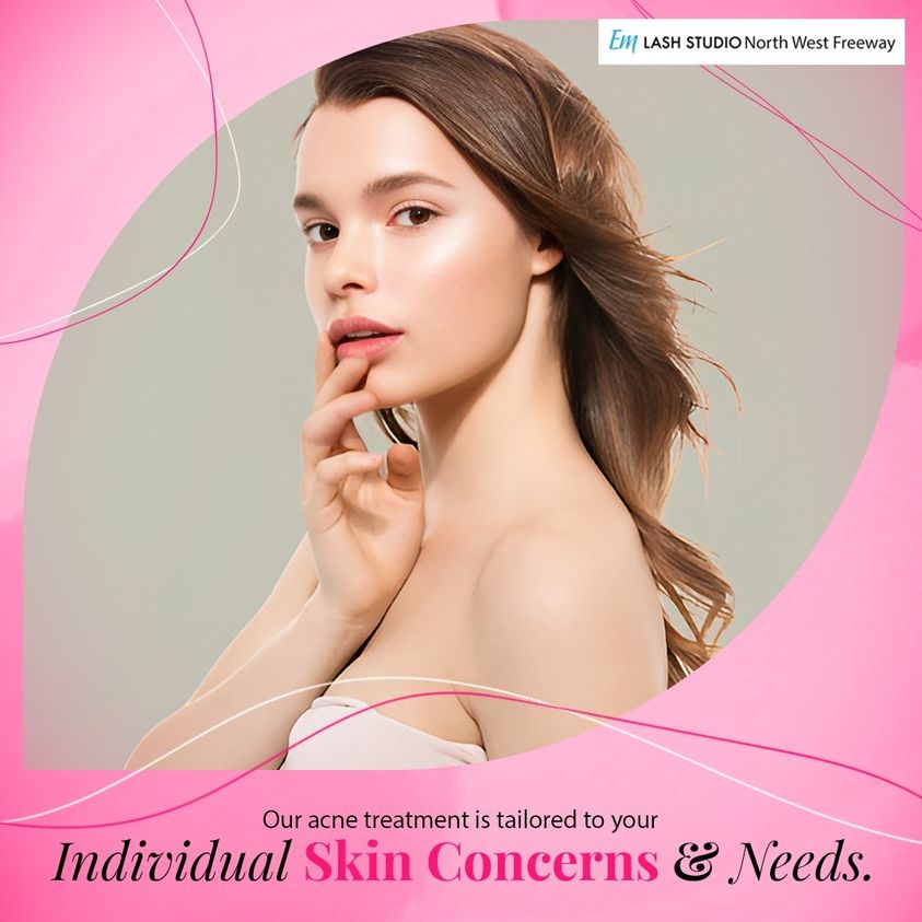 Discover the power of skincare magic ✨
📞 281-616-2612
📍13484 Northwest Fwy, Houston, Texas, 77040, USA.
.
.

#bodywaxing #exfoliation #houstonbrows #houstonlashes #flawlessbrows #flawlesslashes #eyelashextensions #waxing #facialwaxing #threading #facials #browshaping