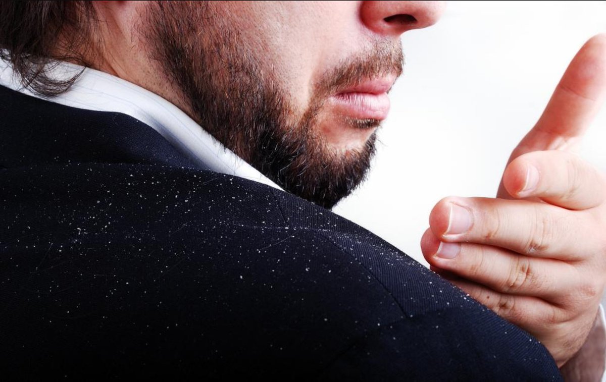FUN FACT FRIDAY...
Dandruff affects everyone. It is estimated that roughly 50% of adults experiences #dandruff. Some studies suggest that #men are more prone to dandruff. 

#metroformen #menshair #funfacts #mensgrooming #mensgroomingtips #shoplocal #orangecountyca