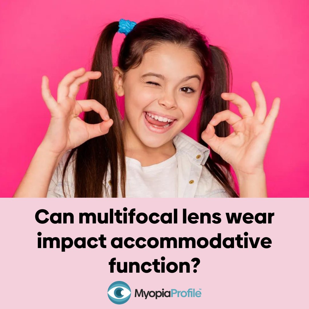 myopiaprofile's tweet photo. The BLINK2 study found that a small short-term change in accommodation response while wearing multifocal contact lenses for myopia control did not translate to long-term effects on children’s accommodative status over longer periods of wear. https://t.co/lBW9ccTm8j https://t.co/OoSen4H2dO