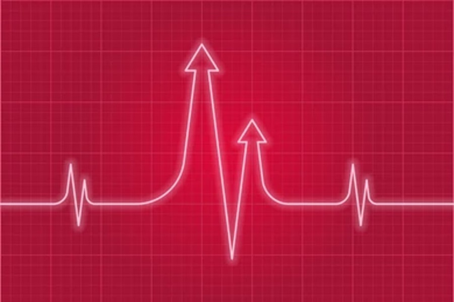 Body_Mysteries's tweet photo. Navigating Danger: How to Respond to Dangerous Heart Rate Spike
https://t.co/SU1lkDl5ZF https://t.co/o4sCFVql34