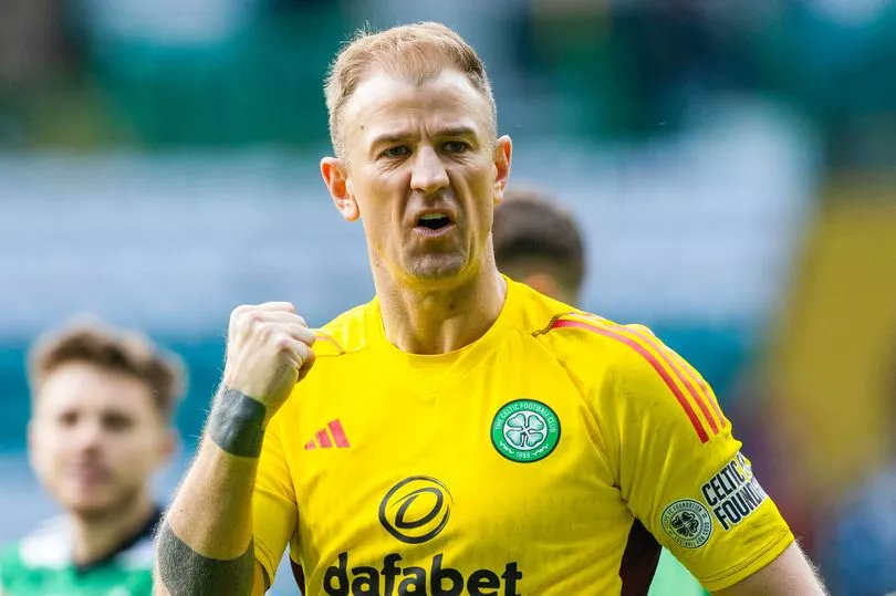Morning Gossip: Hart on Semi-Final 'We have the Scottish Cup & you don’t want any pressure off. It was hard not being involved in the League Cup but we got beat fair & square at Kilmarnock & we had to move on. This is a competition we want to be involved into the very end.' HH