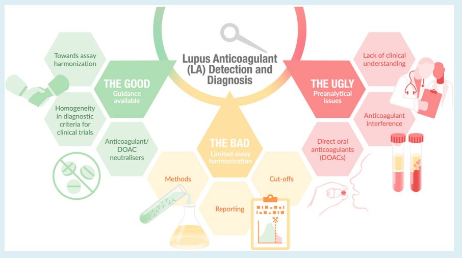 All you wanted to know about lupus anticoagulant but were afraid to ask. Excellent review in the current issue of <a href="/RPTHjournal/">RPTH</a>. As always the PDFs of papers published in this journal are freely available to all. tinyurl.com/4dtpzc9e #lupusanticoagulant #thrombosis