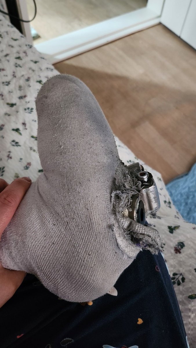 지체4급, 하지 절단 장애.. 그러나 1도 평생을 불편하지 않게 살아온 나는 이번 선거에서 한계를 느끼고 말았다... 고장나있던 의족은 많이 걸어야 했던 광주의 강행군에 버텨내질 못했고 결국 걸을 수 없게 되어 버렸다...그래도 선거 마지막날 까지는 버티게 해주셨음에 감사드릴 뿐...