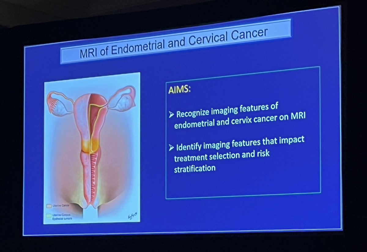 Our #SAR24 Plenary Sessions are off to a superb start! Congrats to my @SARpelvicDFPs mentee @drektam for her excellent #SAR24 presentation on the Imaging of Endometrial & Cervical Cancer. #Mentorship #PayitForward #NextGenExcellence #WomensHealth #EndCancer @SocietyAbdRad