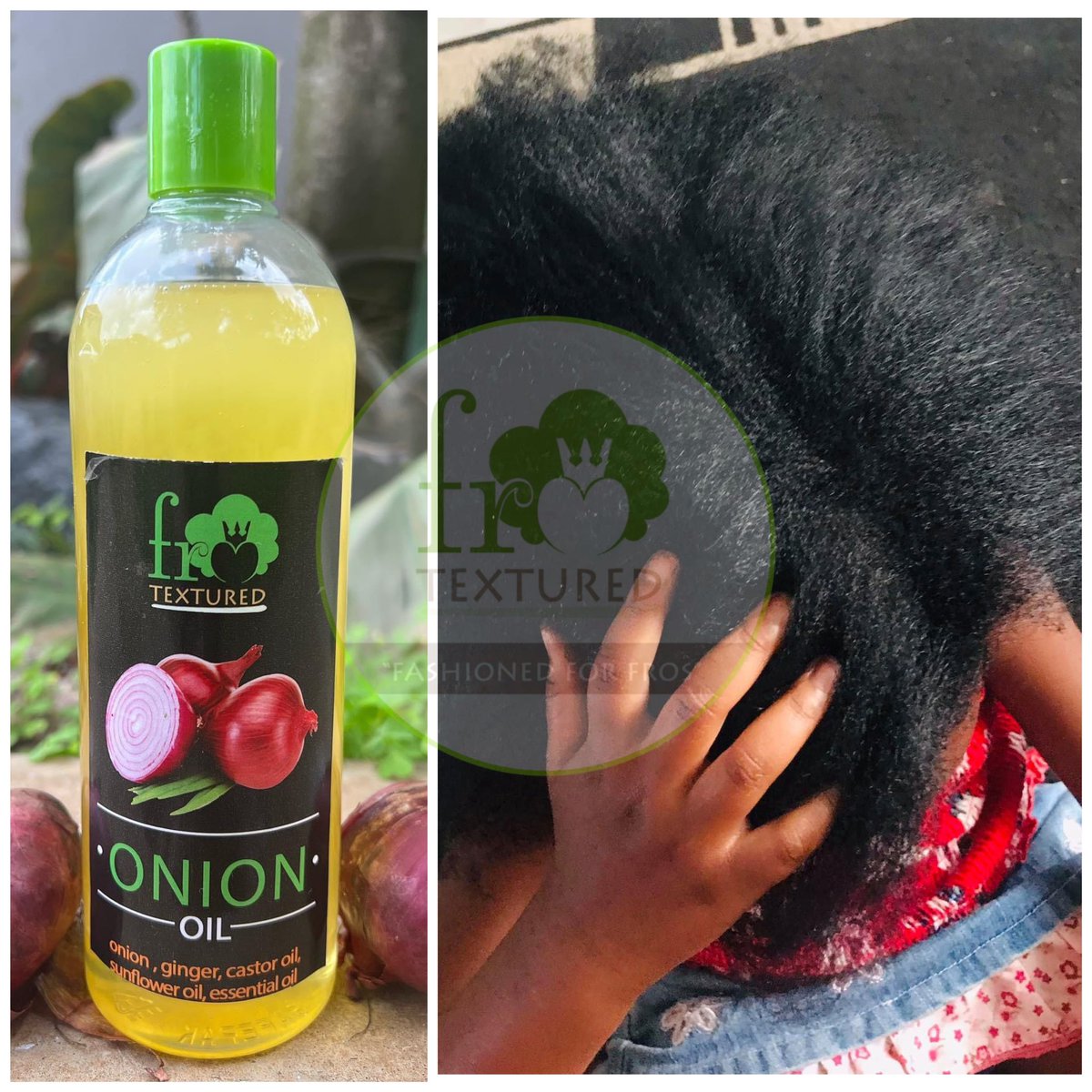 Our onion ginger oil enhances scalp health hence zero dandruff or dryness. Helps moisturize hair , keeps hair shining, & makes hair stronger & lustrous hence never breaking. #onionoil #hairproducts #haircare #hair #naturalhair #hairgoals #healthyhair #hairstyles #uganda #kampala