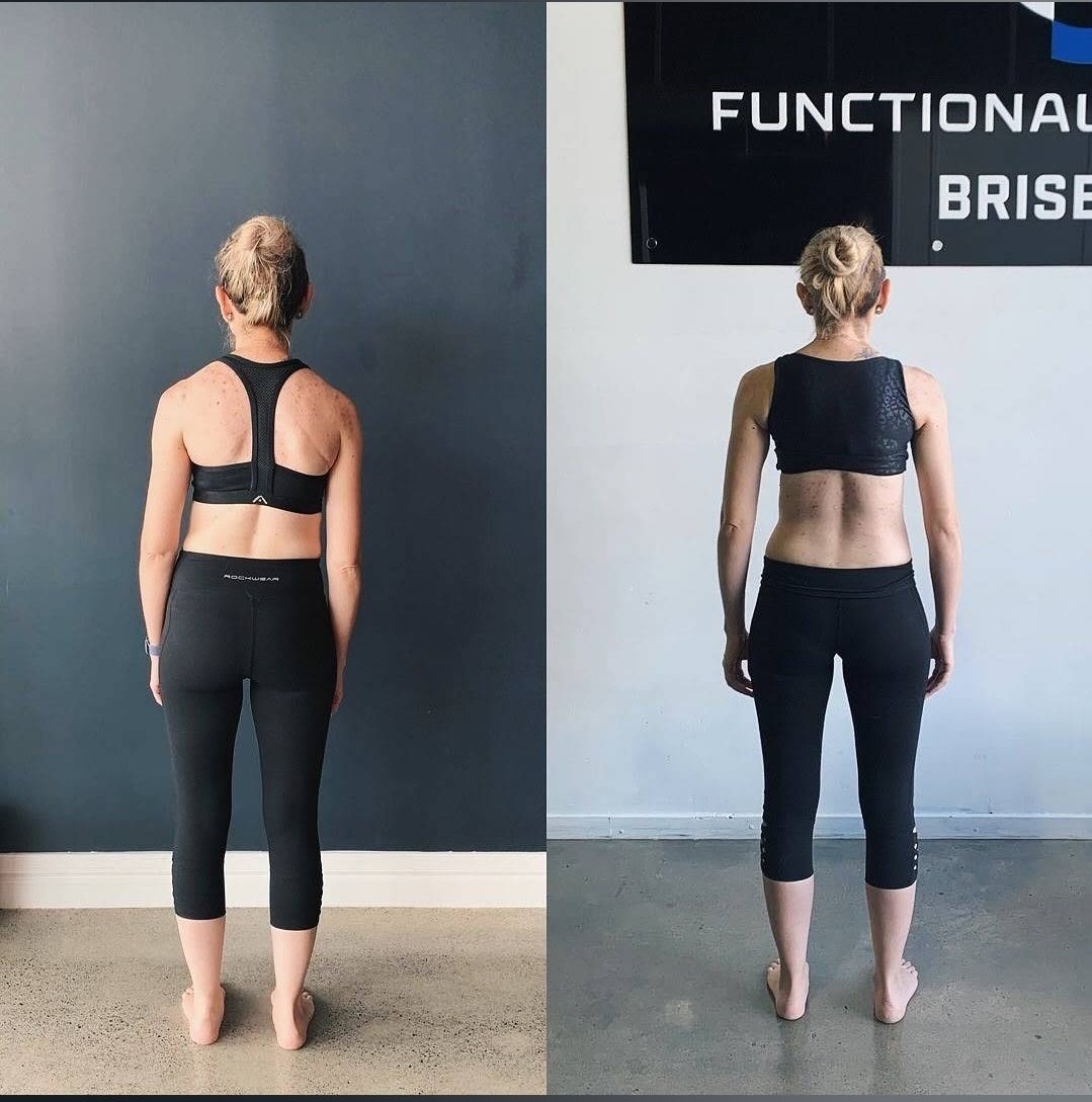 If you are looking for the Best service for #posturecorrection in #torquay, then contact Surf Coast Biomechanics. They can help you improve and move you towards greater functionality. 
Visit- maps.app.goo.gl/LaFUcJxqcWUzEK…