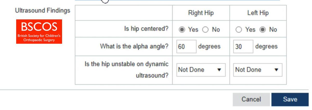 The @BSCOS_UK Core Measurement Set for DDH Ultrasound has now been implemented by @NHSEngland. All babies undergoing hip ultrasound in England now have accurate measurement details recorded in the national computer system to enhance standards.