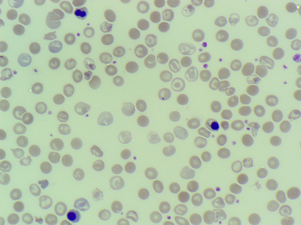 BloodScientist tweet picture