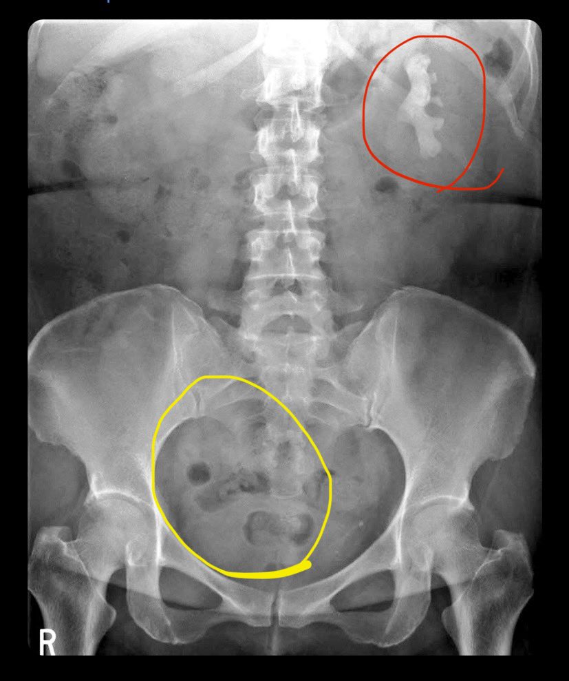 ggjacob's tweet photo. @IhabFathiSulima A dinosaur in the upper left quadrant and a kitten in the right pelvis https://t.co/huKuYWg24Z