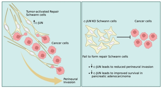 #Schwanncell #cancer #axonregeneration #perineuralinvasion
Trick or treat? Does cancer fool Schwann cells by mimicking axons to promote metastasis into nerves?
journals.lww.com/nrronline/full…
@Cambridge_Uni