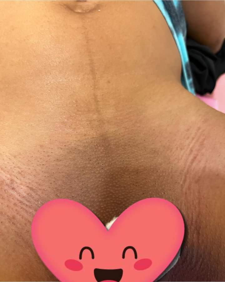 waxonly0's tweet photo. PERFECT WEATHER FOR A GOOD WAX YEAH !!

For all body waxing services 
BOOK WITH US! 

0974029936
kitwe (CBU) https://t.co/GZtNiysUSu