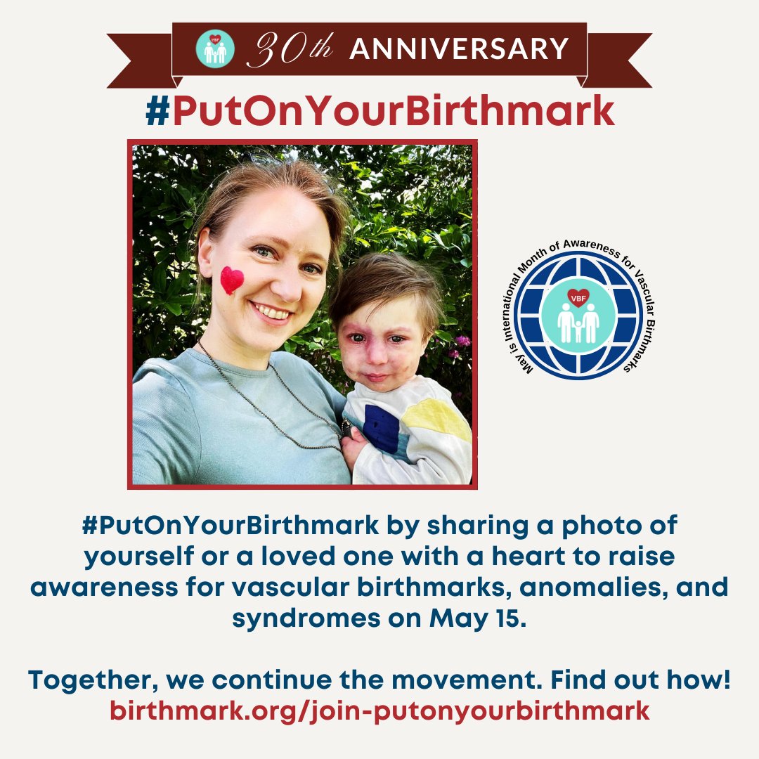 One month until the VBF International Day of Awareness for all Vascular Birthmarks, Anomalies and/or Related Syndromes (VBARS) on May 15. Explore birthmark.org/support/day-of… Whatever action you take is an important step towards raising awareness for vascular birthmarks.