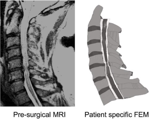 Myelopathy org tweet media