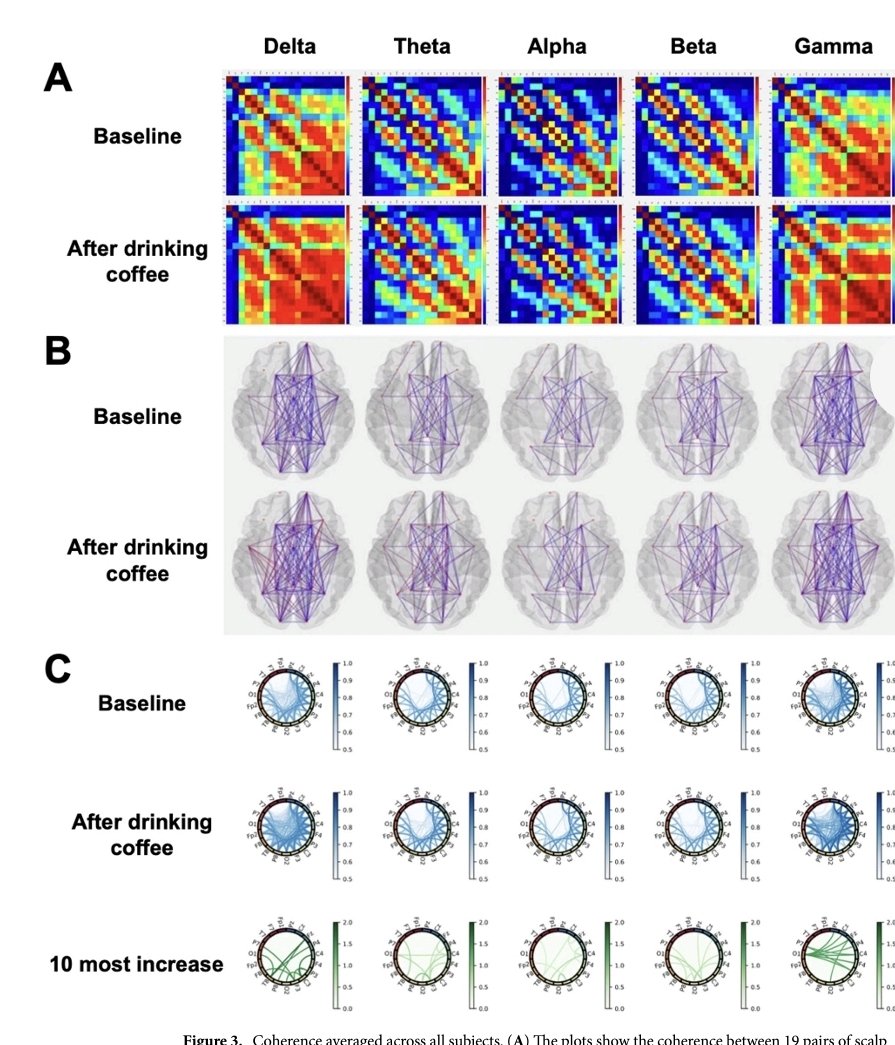 LeslieMegom's tweet photo. ☕️Los bebedores habituales de café muestran un patrón distintivo de conectividad funcional cerebral🧠NATURE Scientific Reports 
🧠Conectividad funcional antes y desp. de beber café mediante un análisis  de EEG.  
👇🏽👇🏽👇🏽👇🏽
https://t.co/v4CLeipquH
🗝🔓
https://t.co/v4CLeipquH https://t.co/5y7blENvuB