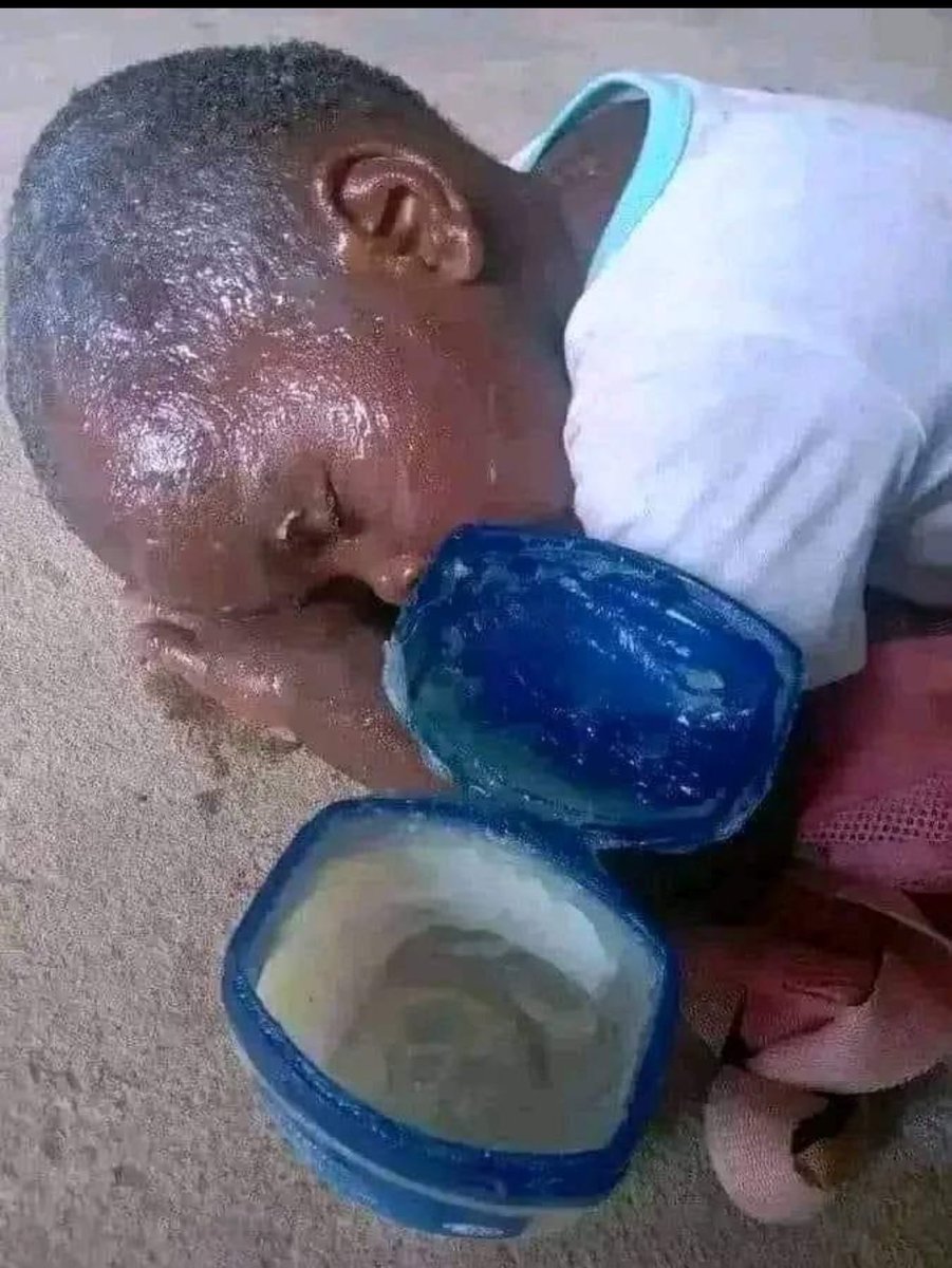MrX549's tweet photo. Cakozee urugwana nakasa #mutwe 😄🤣🤣 vazerine arayimazee #kumusumwe 🥲🥲 https://t.co/k4lNmZmPmW