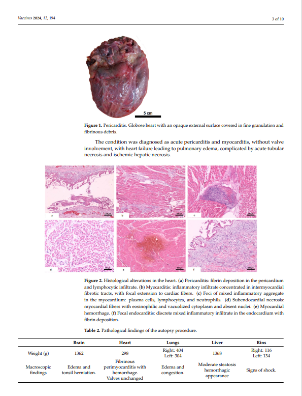 7 year old boy dead 'Fatal Myocarditis'

We report a case of infant death due to pericarditis and myocarditis after the 1st dose #Pfizer #mRNA vaccine.
ncbi.nlm.nih.gov/pmc/articles/P…