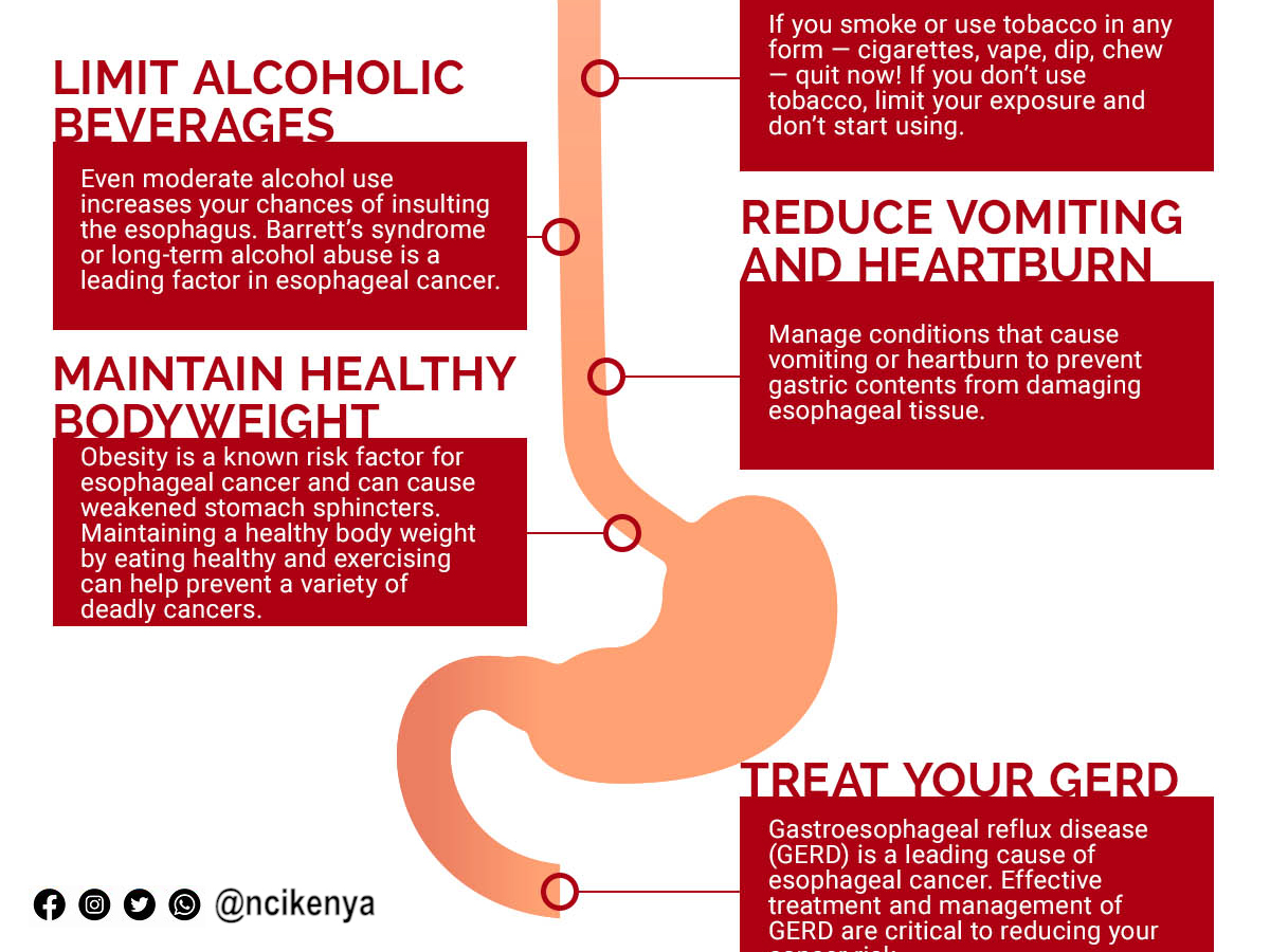 What can you do to reduce your risk for oesophageal cancer? 1. Limit alcoholic beverages. 2. Maintain healthy body weight. 3. Limit your exposure or smoking rate. 4. Reduce vomiting and heartburns. What can you do to reduce your risk for oesophageal cancer? 1. Limit alcoholic beverages. 2. Maintain healthy body weight. 3. Limit your exposure or smoking rate. 4. Reduce vomiting and heartburns.