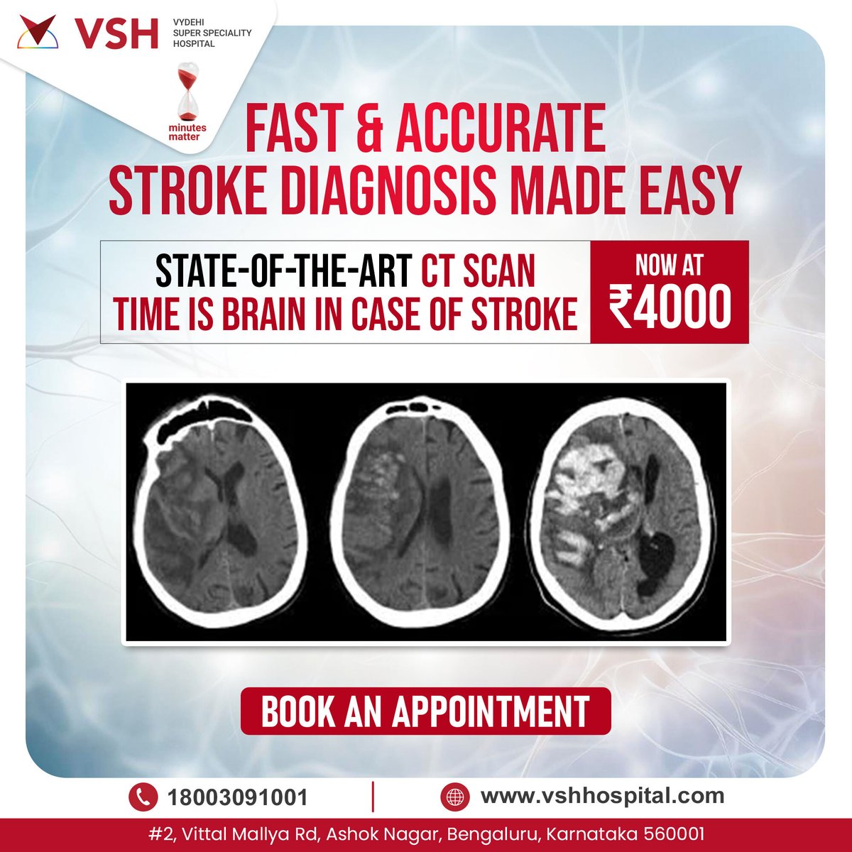 Think you might be having a stroke?  Don't wait! VSH Hospital's fast & accurate CT scans diagnose strokes quickly for effective treatment. Time is brain. ⏱️ Get the care you need. Choose VSH Hospital. #StrokeAwareness #CTScan #VSHHospital
#EverySecondCounts #MinutesMatter