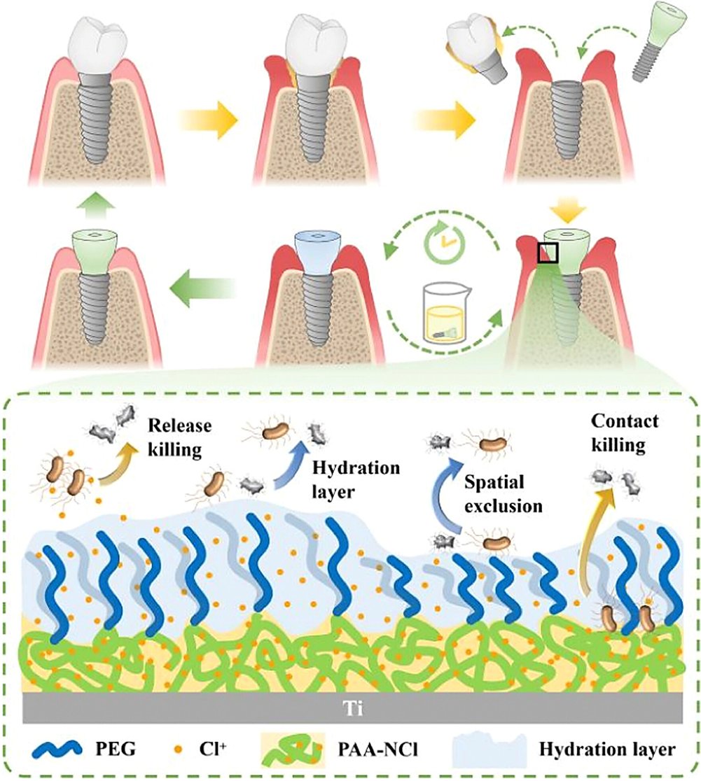 Coral-inspired anti-biofilm therapeutic abutments as a new paradigm for prevention and treatment of peri-implant infection
@Wiley_Chemistry  @wileyinresearch @InnovationChem @isciverse @Mat_Innov @AdvSciNews @Pedia_Dent 

doi.org/10.1002/smm2.1…