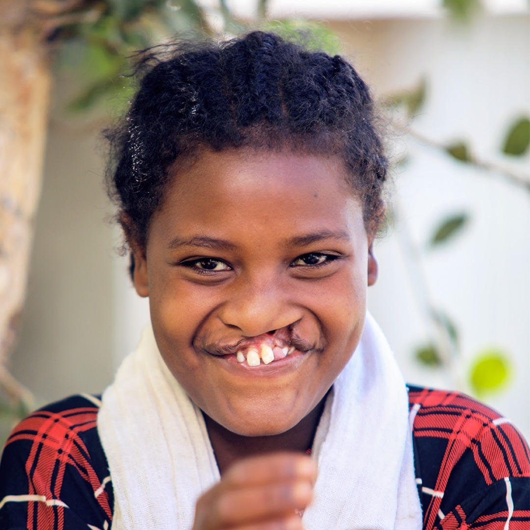 Meet 13-year-old Alganesh from Ethiopia, born with a cleft, refused to go to school due to fear of bullying. Thanks to Smile Train's local partner hospital, Tibebe Ghion, she is now receiving the cleft care she deserves! ❤️ 💙 ❤️ 🇪🇹