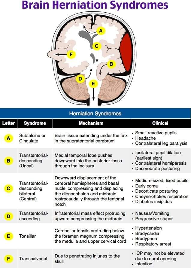 Neurosurgery Cocktail (@BipinChaurasia_) on Twitter photo 2024-04-15 15:28:03