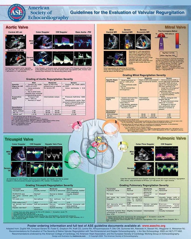 ASE Valvular Stenosis and Regurgitation Guidelines 📚 

— summarized in just two infographics (for all 4 valves) 

#cardiology #echofirst #cardioX