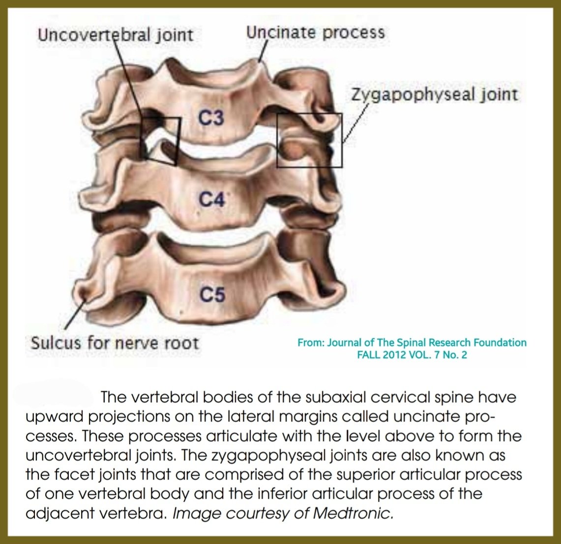 Movement of C-spine involves combination of uncovertebral & zygapophyseal motion. During neck flexion,zygapophyseal & uncovertebral joints glide in a combined superior,lateral& anterior direction. During neck extension, joints glide in a combined inferior,medial&post direction