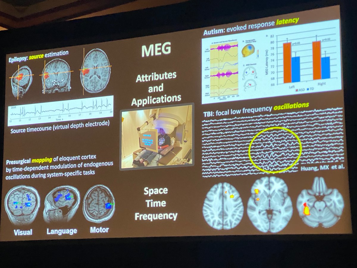 Timothy P. Roberts from @CHOPRadiology discussed magnetic source imaging/magnetoencephalography (MEG). MEG can be used to monitor neural activity in epilepsy and for functional mapping. Wearable MEG systems are now available. @SocPedRad 2024 #pedineurorad #pedsrad
