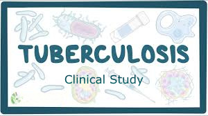 A St George’s University of London study shows how tuberculosis can have a lasting impact on the lung health of individuals who have been successfully treated - check the link for more details  ow.ly/pMWZ50Rg2eN @StGeorgesUni #Tubercolsis #LungHealth #MedicalStudy