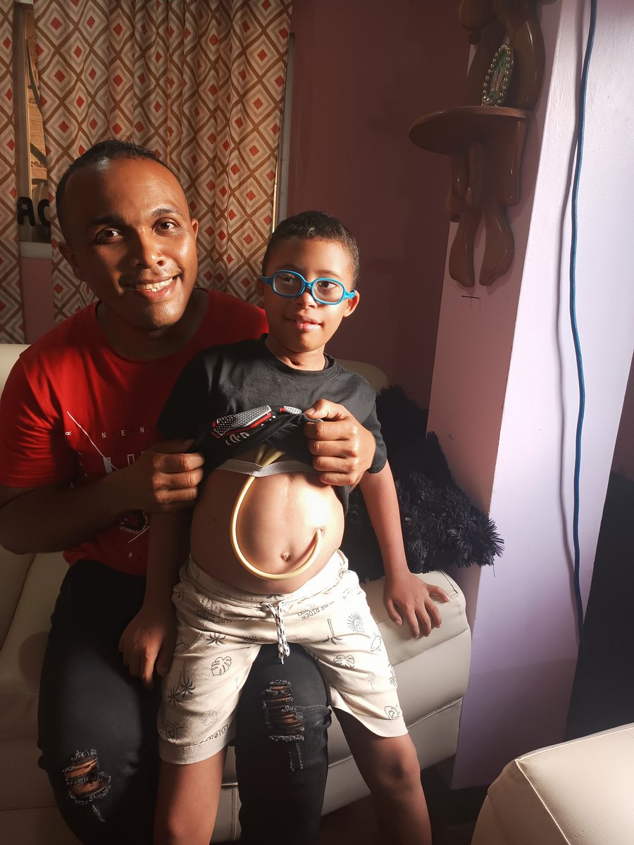 LuisReyes_30's tweet photo. #Ayuda Vamos a darle la mayor difusión posible al caso de Josué. Este niño de 13 años, sobreviviente de cáncer, requiere una cirugía de tórax. Su madre Orfa ha acudido a muchos hospitales, sin respuesta.
Él se alimenta a través de una sonda.
@AlexaGomezDos
#URGENTE
#CasoSocial https://t.co/ftsurvzRZG