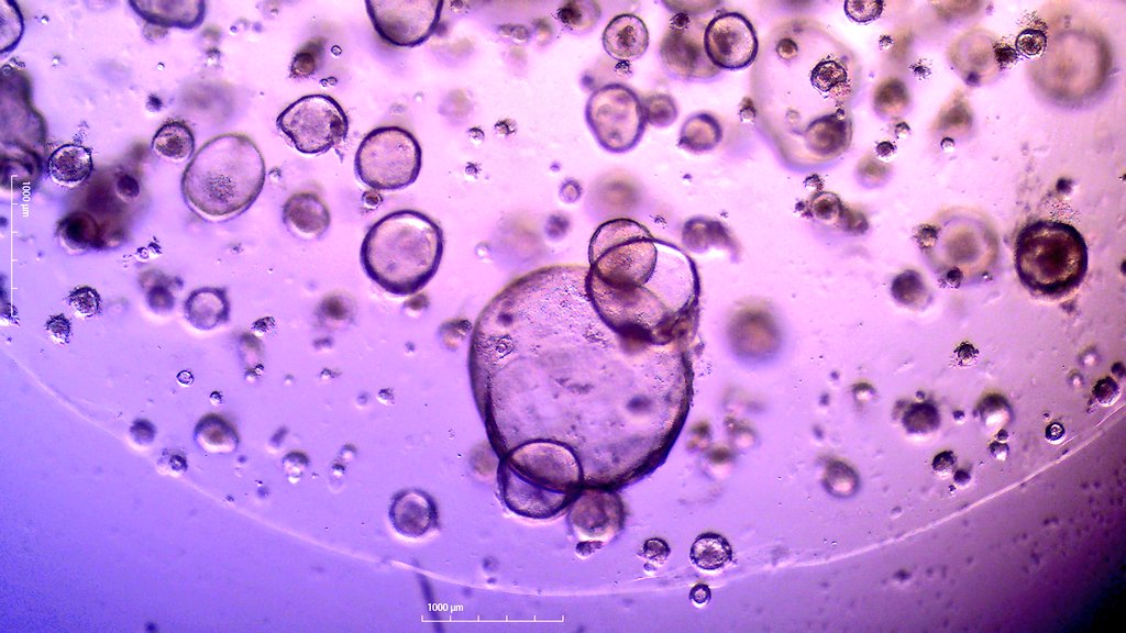 Some cute liver organoids for #MicroscopyMonday!

#microscopy #organoids