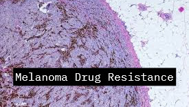 Spanish researchers at the Center for Genomic Regulation unveil how melanomas develop drug resistance - please check the link for more information - ow.ly/HX8V50Rg4fY  @CRGenomica #Melanoma #DrugResistance  #CancerResearch  #MedicalResearch